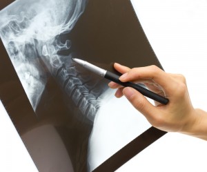 xray pointing with pen